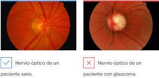 Imagen 3